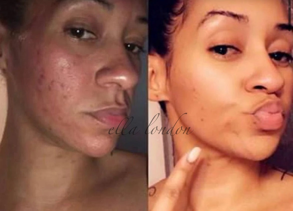 Sidr' Skin & Scalp Healer