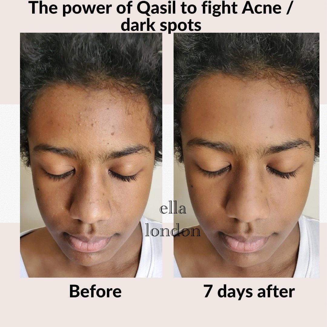 Sidr' Skin & Scalp Healer